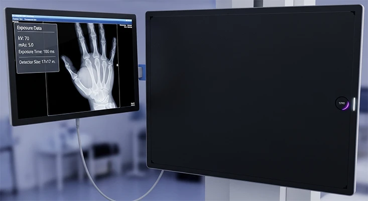 Detector plano digital (FPD) de equipo de Rayos X digitales